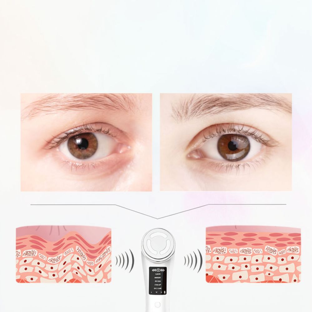 プロ仕様のスキンケアマッサージャー、顔の引き締め効果のある美 - Photon Light Therapy Device Skin のレビューと価格